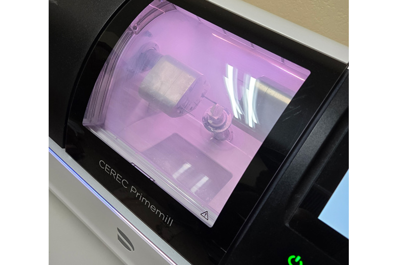 Same Day Dental Crowns in Chandler